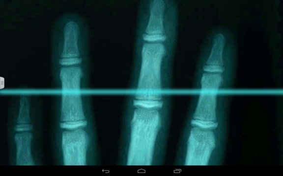 xray scanner apps android 2