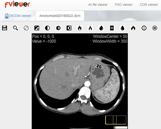 Fviewer in action