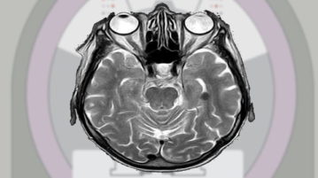 5 Free Online Dicom Viewer Websites to Open and View DCM Files